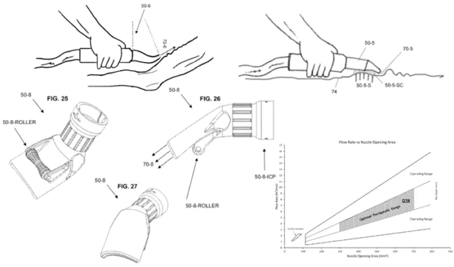 Slipstream edema solution